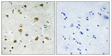 IHC - Ribosomal Protein L34 Polyclonal Antibody AP72291